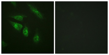 NFATc4 antibody