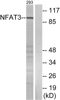 NFATc4 antibody
