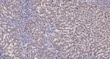 NFR kappa B antibody