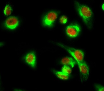 NFκB-p100 rabbit pAb Antibody