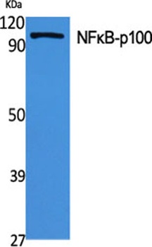 NFκB-p100 rabbit pAb Antibody