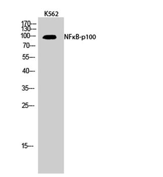 NF kappa B-p100 antibody