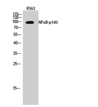 NFκB-p100 rabbit pAb Antibody