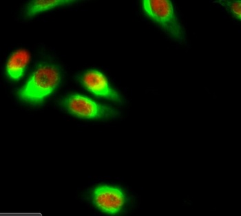 NFκB-p65 rabbit pAb Antibody