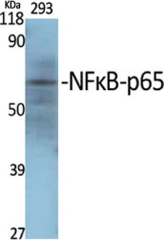 NFκB-p65 rabbit pAb Antibody