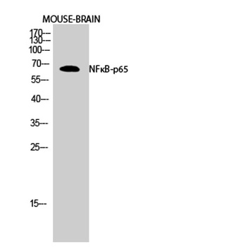 NFκB-p65 rabbit pAb Antibody