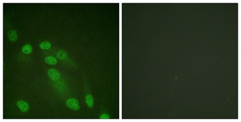 NFκB-p65 rabbit pAb Antibody