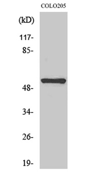 Neurokinin B receptor antibody