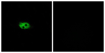 Neurokinin B receptor antibody