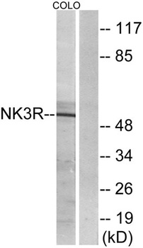 Neurokinin B receptor antibody