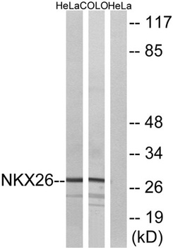 Nkx-2.6 rabbit pAb