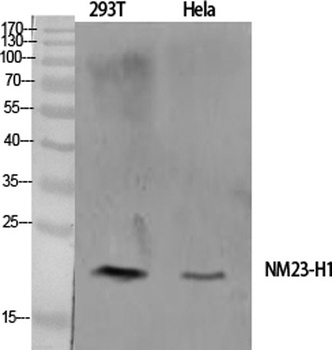 NM23-H1 rabbit pAb