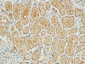NM23-H1 antibody