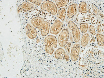 NM23-H1 antibody