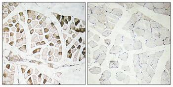 Nogo A antibody