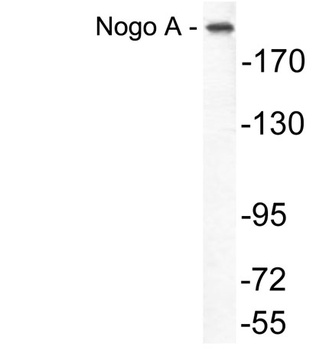 Nogo A antibody