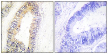 NP220 antibody