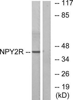 NPY2-R rabbit pAb