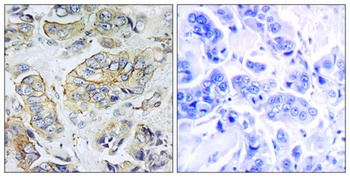 NPY5-R antibody