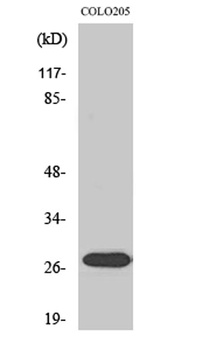 NRIP3 rabbit pAb Antibody