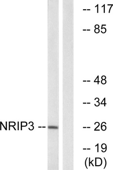 NRIP3 rabbit pAb Antibody