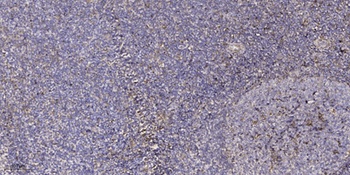 NRIP3 rabbit pAb Antibody