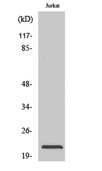 NTPase rabbit pAb Antibody