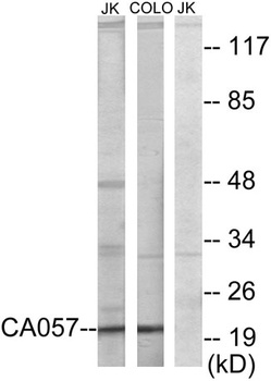 NTPase rabbit pAb Antibody