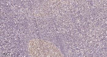 Nucleophosmin rabbit pAb