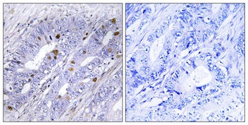 Nur77 antibody