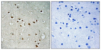 NY-CO-1 antibody