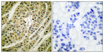 NY-CO-9 antibody