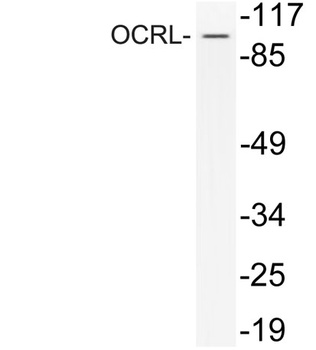 OCRL rabbit pAb