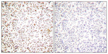 OTF1 antibody