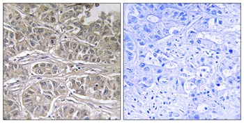 ODC antibody