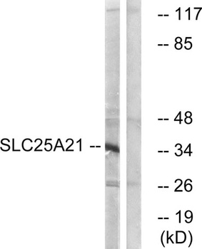 ODC antibody