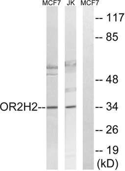 Olfactory receptor 2H2 rabbit pAb Antibody
