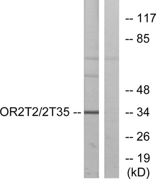 Olfactory receptor 2T2/35 antibody