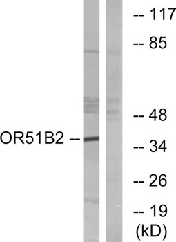 Olfactory receptor 51B2 antibody