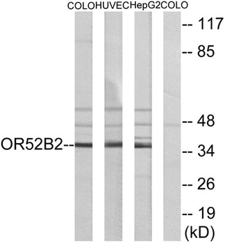 Olfactory receptor 52B2 rabbit pAb