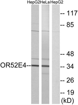Olfactory receptor 52E4 rabbit pAb