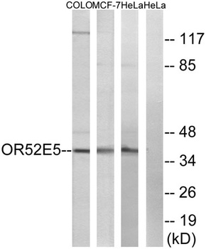 Olfactory receptor 52E5 rabbit pAb