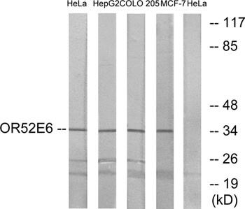 Olfactory receptor 52E6 antibody