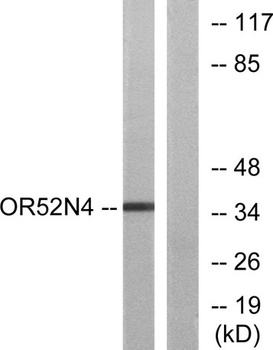 Olfactory receptor 52N4 rabbit pAb