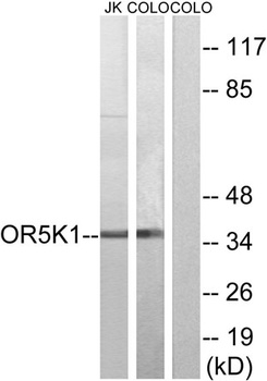 Olfactory receptor 5K1 antibody