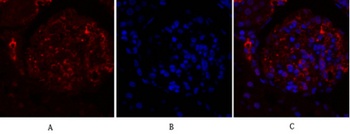 OPG antibody