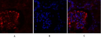 OPG antibody