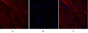 OPG antibody