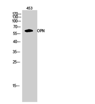 Osteopontin antibody