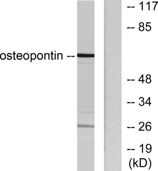 Osteopontin antibody